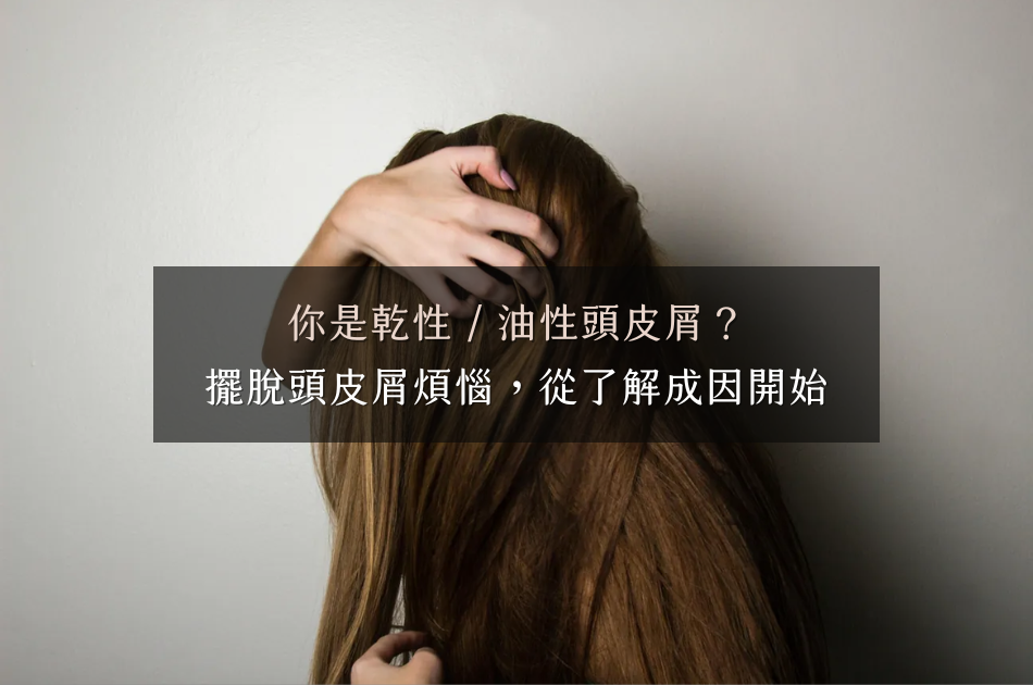 你是乾性 / 油性頭皮屑?擺脫頭皮屑煩惱,從了解成因開始