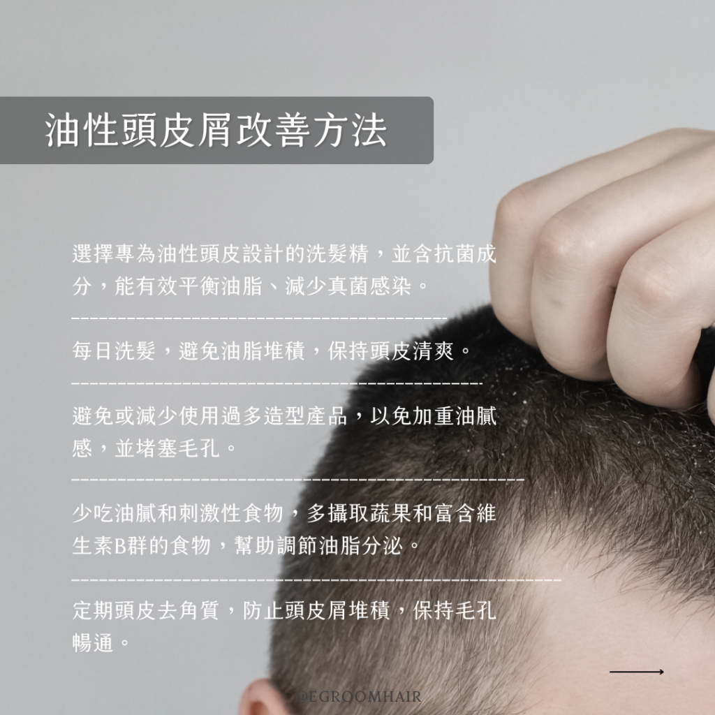 油性頭皮屑的改善方法：選擇專為油性頭皮設計的洗髮精、每天洗髮，保持頭皮清爽、避免使用過多造型產品、改變飲食習慣、定期頭皮去角質